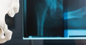 INTUITIVE SURGICAL – Heftiger Kurseinbruch vor den Zahlen