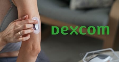 DEXCOM – Margensprung und Rallyschub